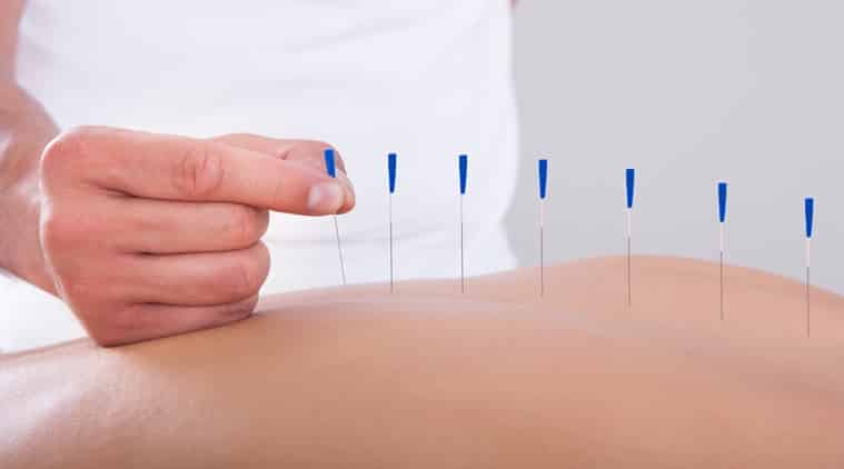 Wave off menopause symptoms with acupuncture