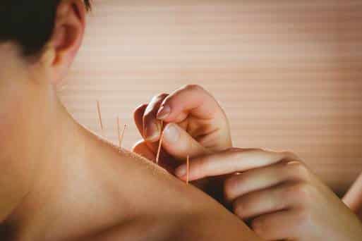 Acupuncturists making their point on allergies