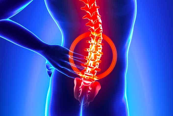 Acupuncture Found Effective For Lumbar Disc Herniations